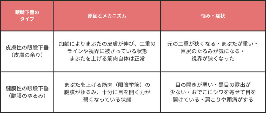 眼瞼下垂のタイプをセルフチェック