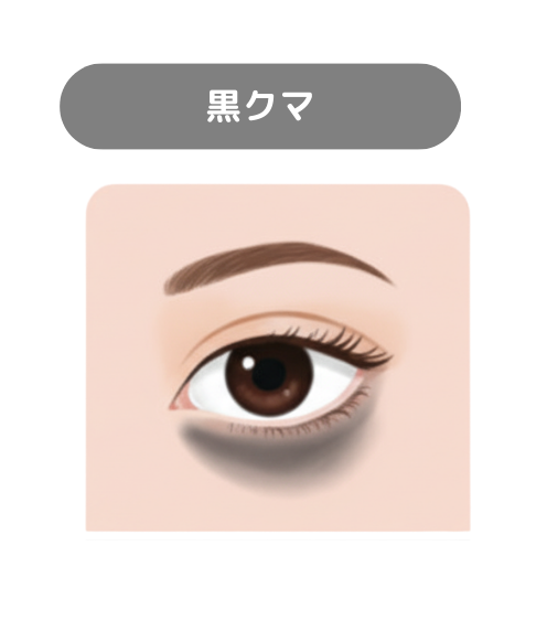 黒クマ