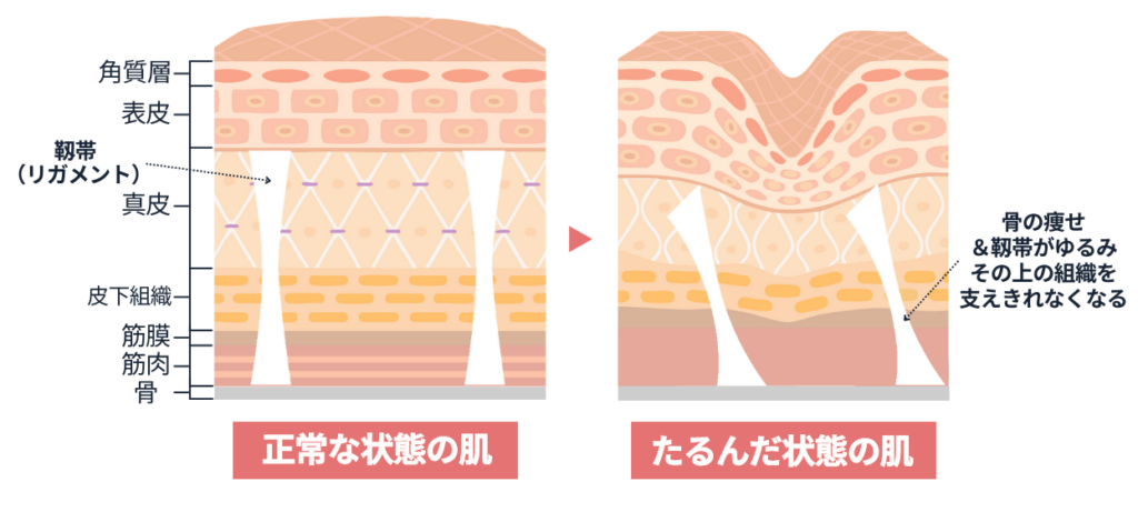 顔の土台のゆるみイメージ